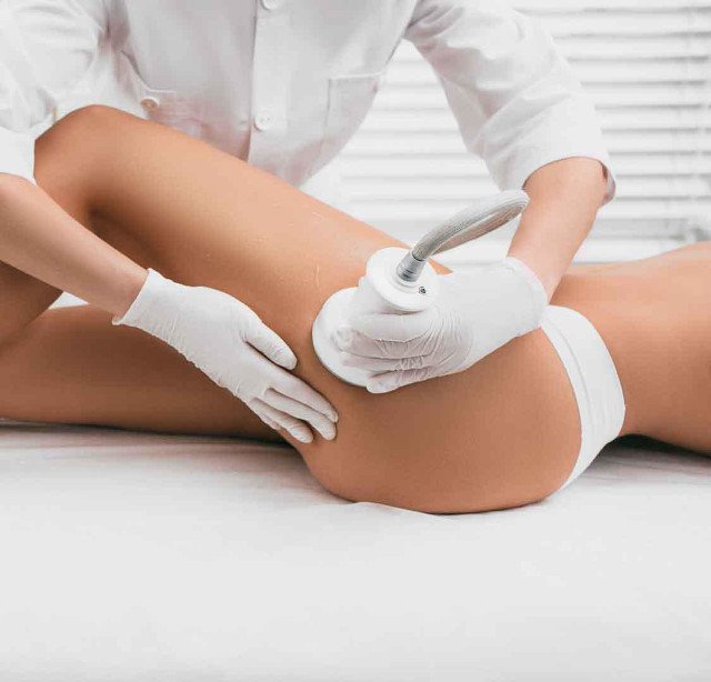 CAVITATION RF - VACUUM RF