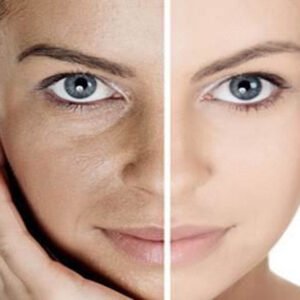 ΜΕΣΟΘΕΡΑΠΕΙΑ ΠΡΟΣΩΠΟΥ