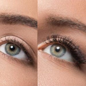 ΒΑΦΗ ΒΛΕΦΑΡΙΔΩΝ