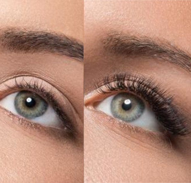 ΒΑΦΗ ΒΛΕΦΑΡΙΔΩΝ